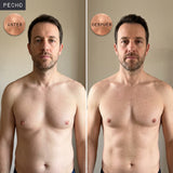 ForceLabs antes y despues pecho